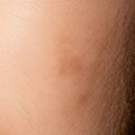 30대부터 시작되는 피부 시계 미래의 당신 피부를 좌우할 피부노화 전망 파헤치기.jpg